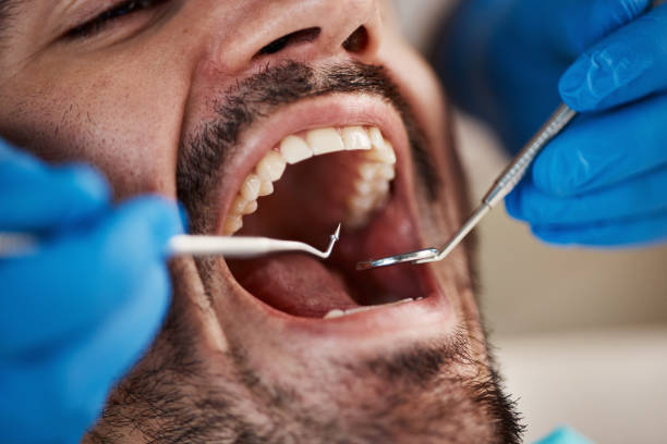 Best Root Canal Emergency Dentist  in Reynoldsville, PA