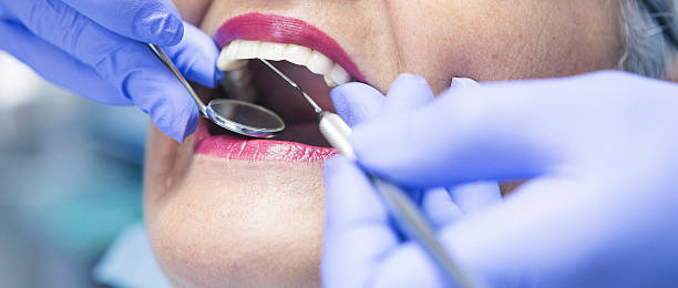 Best Emergency Dental Filling Replacement  in Reynoldsville, PA